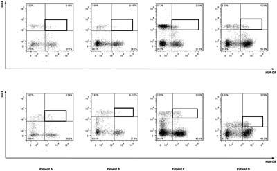 CD4 Donor Lymphocyte Infusion Can Cause Conversion of Chimerism Without GVHD by Inducing Immune Responses Targeting Minor <mark class="highlighted">Histocompatibility Antigens</mark> in HLA Class II
